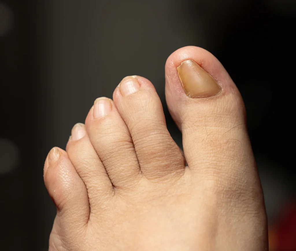 News at South London Foot Clinic