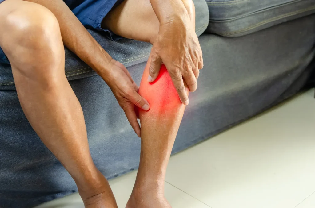 Leg Pain