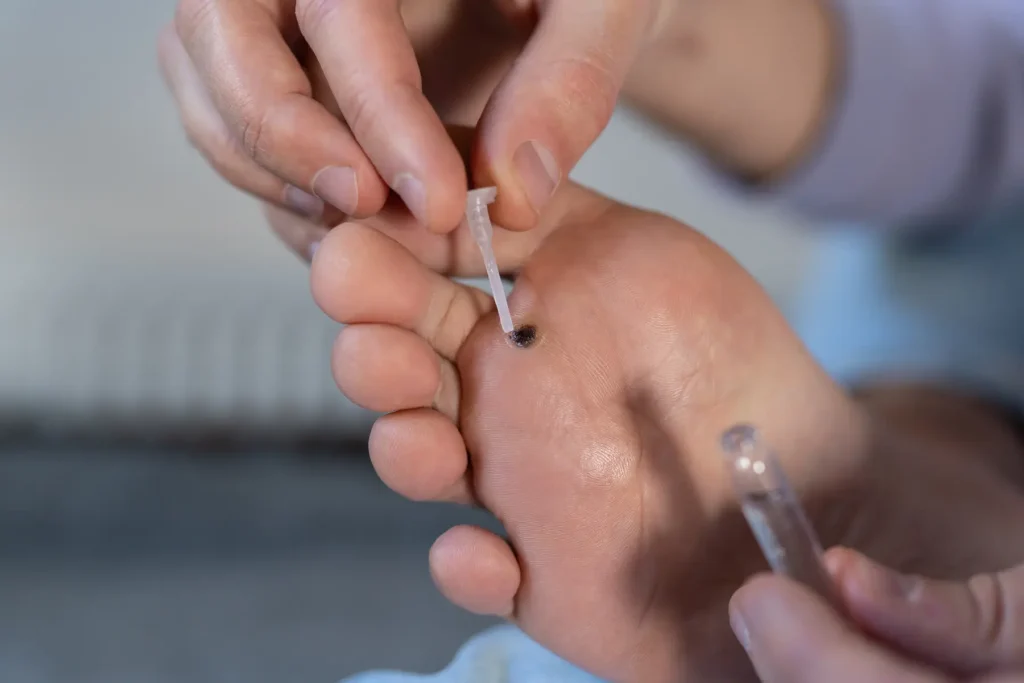 Verruca Treatment